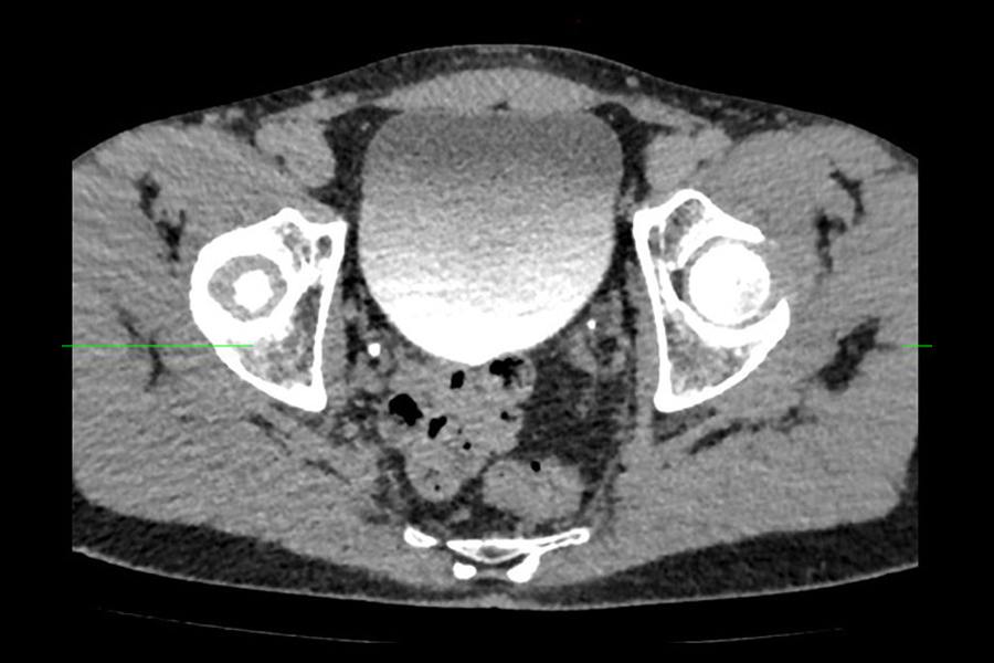 ct-ivp